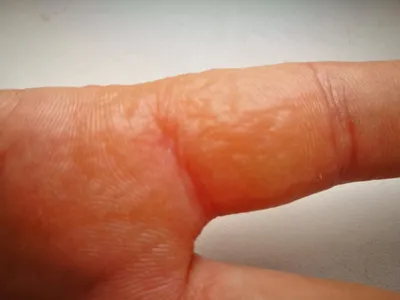 Пузырьки на пальцах рук: изображение в формате JPG с эффектом дождя