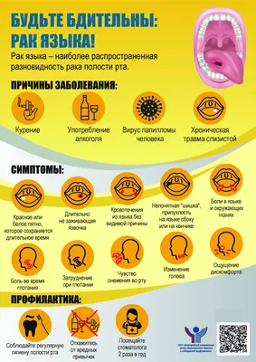 Рак Языка — стоковые фотографии и другие картинки Раковая опухоль - Раковая  опухоль, Медицинский осмотр, Язык - орган тела - iStock