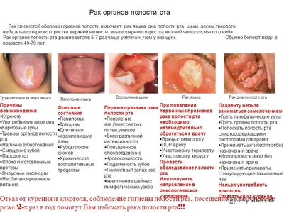 Рак языка: диагностика и оперативное лечение в Одессе | Медицинский дом  Odrex