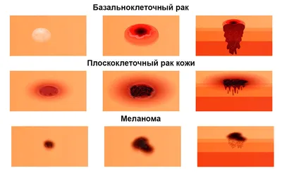 Раскраска рак . раскраска рак. Картинки раскраски.