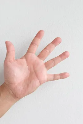 Изображение рака пальца руки