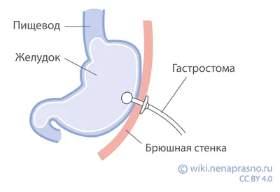 Лечение рака пищевода в Израиле — Отзывы, стоимость | Медицинский центр  Рамбам