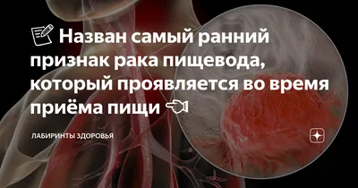 Рак пищевода: диагностика и лечение