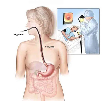 Лечение рака пищевода - причины, симптомы, диагностика | онкоцентр \"АСС  Медикал\" в Москве
