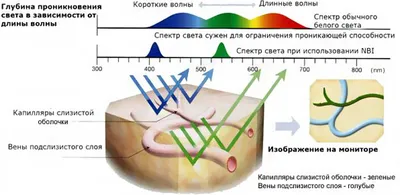 Плюсы и минусы! КТ, УЗИ или МРТ тазобедренного сустава - отличия и  диагностическая разница