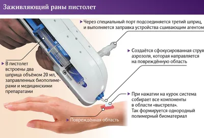 Альгипор-м покрытие на раны и ожоги стерильное 60х100 мм 1 шт. - цена 223  руб., купить в интернет аптеке в Москве Альгипор-м покрытие на раны и ожоги  стерильное 60х100 мм 1 шт.,