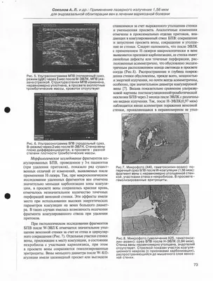 Распознавание текста документов