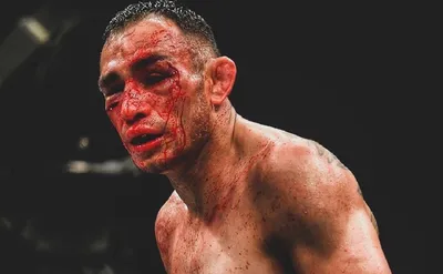 Боец UFC показала изуродованное лицо после турнира в Лас-Вегасе - РИА  Новости Спорт, 17.04.2022