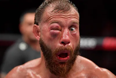 _-- [UFC Uruguay] Mike Perry Broke His Nose, BIG TIME! --_-- #sportstalk —  Steemit