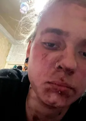 Учителя молчали»: десятиклассница засудила школу за травлю и разбитое лицо  | КП - Новосибирск | Дзен