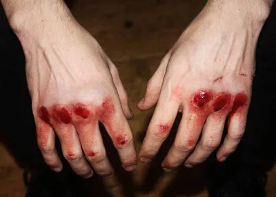 Разбитые руки в кровь: фото в формате JPG