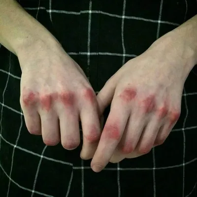 Разбитые руки в крови: фото в формате WebP