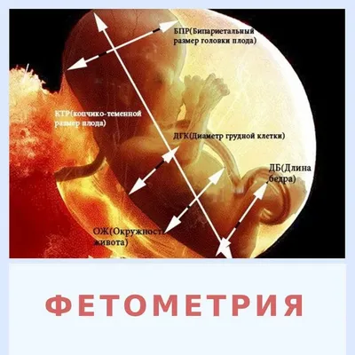 УЗИ при беременности - на каких сроках делают плановые УЗИ беременным