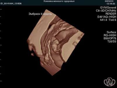 Развитие плода - неделя 25 иллюстрация штока. иллюстрации насчитывающей плод  - 58830310