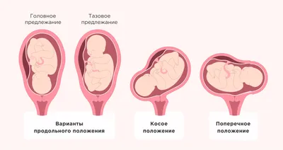 Положение ребенка в утробе матери Иллюстрация вектора - иллюстрации  насчитывающей икона, матке: 203195548