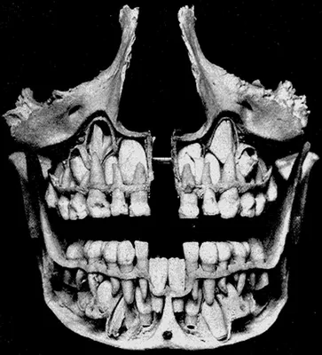 Рентген черепа ребенка в формате JPG