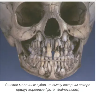 Уникальное изображение рентгена черепа ребенка