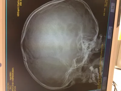 Фото рентгена черепа ребенка для научных исследований