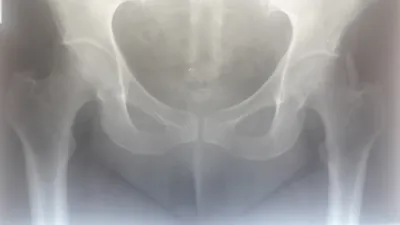 Фото рентгена черепа ребенка для медицинской документации