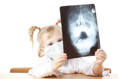 Фото рентгена черепа ребенка для медицинских целей