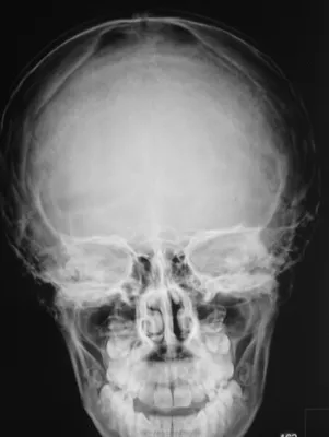 Изображение рентгена черепа ребенка высокого разрешения