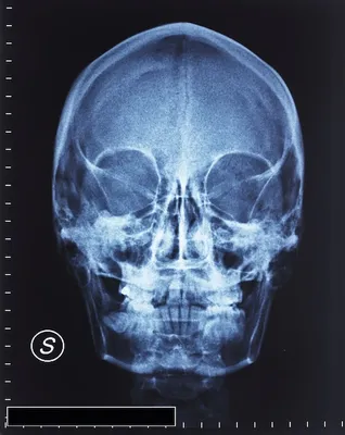 Рентген черепа в формате JPG