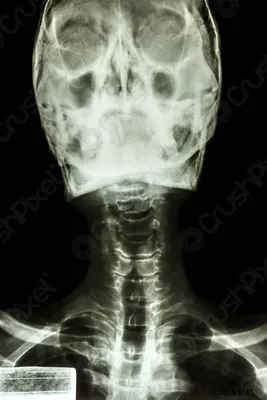 Картинка черепа в рентгеновском излучении с наклоном