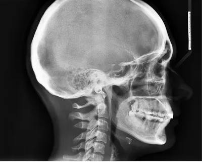 Изображение черепа с дополнительной информацией о зубах