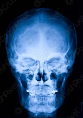 Изображение рентгена черепа в высоком разрешении