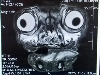 Фото черепа в рентгеновском излучении с градацией серого
