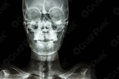 Рентген черепа для анализа зубов