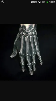 Фото рентгена кисти руки: рентгеновские лучи