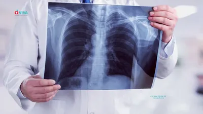 Картинка кисти руки с контуром костей на фоне рентгена