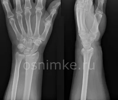 Рентгеновский снимок руки в анатомическом разрезе