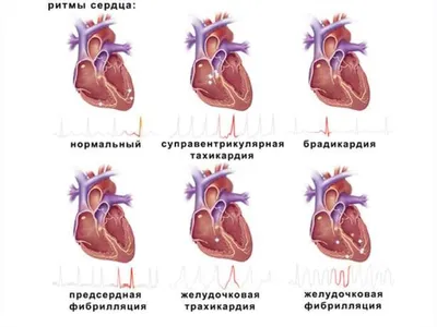 Ритм сердца картинки фото