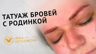 Фотография Родинка татуаж на ноге