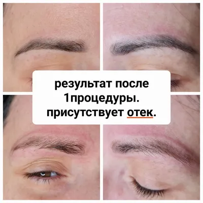 Родинка татуажа в виде сердца