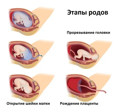 Роды как естественный процесс | Пикабу