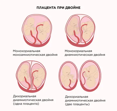 22 неделя беременности: ребенок улыбается! | Счастливый Ребенок | Дзен