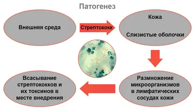 Новый набор изображений Рожа на руке лечение: скачайте их сейчас!