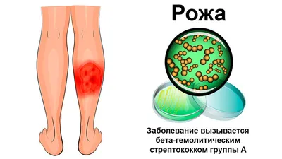 Красивая рожа на руке в высоком разрешении