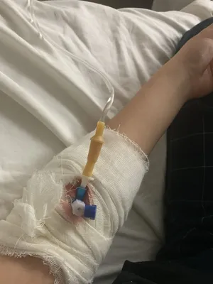 Фотография руки с капельницей в больнице в натуральных тонах
