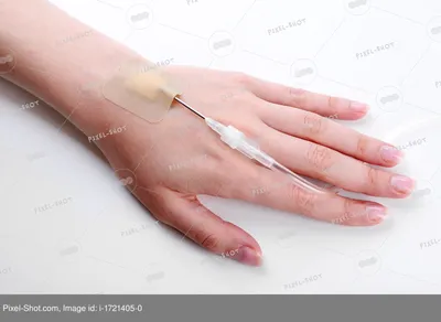 Изображение руки с капельницей: готовое решение для медицинских сайтов