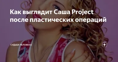 Саша Project до и после пластики