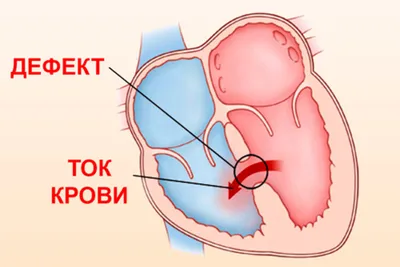 Стартовал прием документов на региональный этап Всероссийского конкурса « Сердце отдаю детям – 2023»