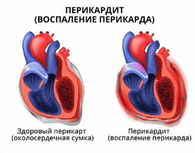 Pop it Big Size большое сердце, Антистресс / радужный круг / Вечная пупырка  / Давилка / Пупырка / Подарок для детей - купить с доставкой по выгодным  ценам в интернет-магазине OZON (262539478)