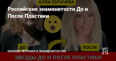 10 знаменитостей, которых испортила ринопластика: от \"носиков\" до \"носищ\"