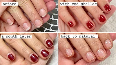 Gel Nails vs. Shellac Nails: Which Manicure Is Better?