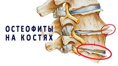 Изображение шишек на пальцах рук на фоне заката