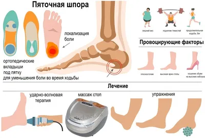 Больно наступать на пятку?» Пяточная шпора: причины, симптомы, лечение |  Жан Шоломицкий | Дзен